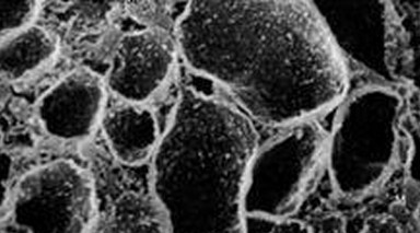 human prolactin